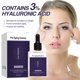 thumbnail image 1 of Fiudx Crema Reafirmante Facial, Crema Reafirmante y Reafirmante, Suero Hidratante Iluminador, Solución Antiedad para La Piel, Uso Diario Nocturno, para Mujeres Mayores de 30 Años, Frasco de 30 Ml, 1 of 7