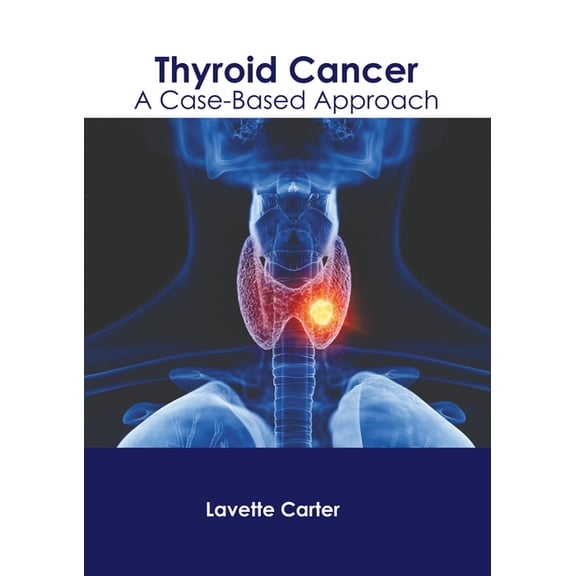 Thyroid Cancer: A Case-Based Approach, (Hardcover)