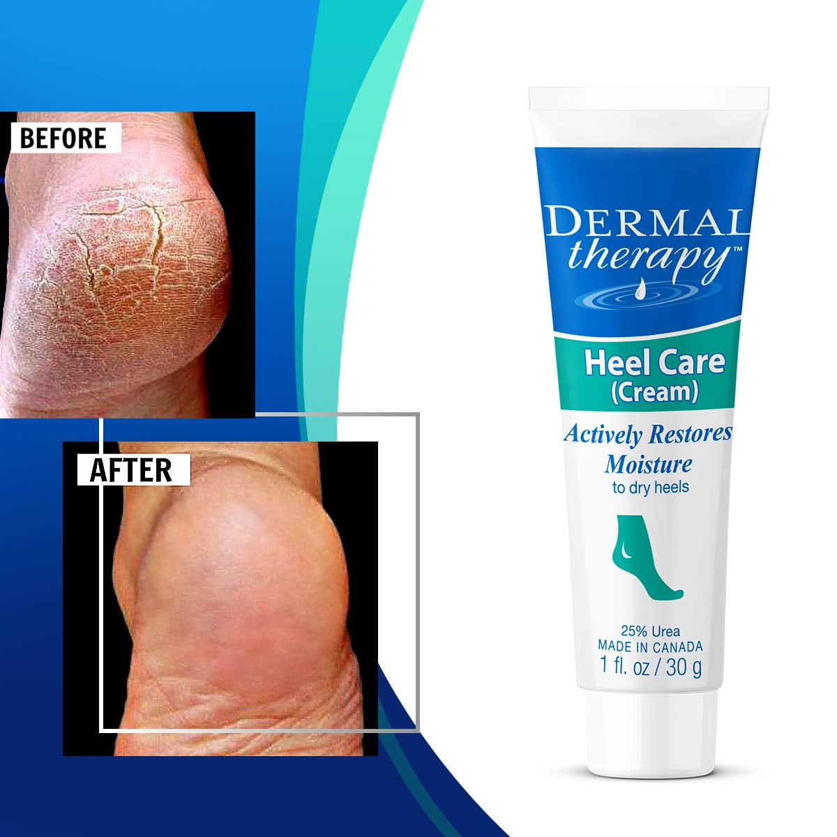 derma therapy cream