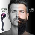 thumbnail image 2 of Beard Roller,540 0.5mm Titanium Needles/derma Roller Hair Growth Men Beard Roller For Growth For Men, Beard Growth Roller Stimulate Beard And Hair Gro, 2 of 5