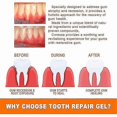 thumbnail image 5 of EELHOE Teeth Repair Bottle Tooth Decay Repair Repair All Tooth Decay And Protect Teeth Remove Plaque Tooth Decay Repair Tooth W, 5 of 5