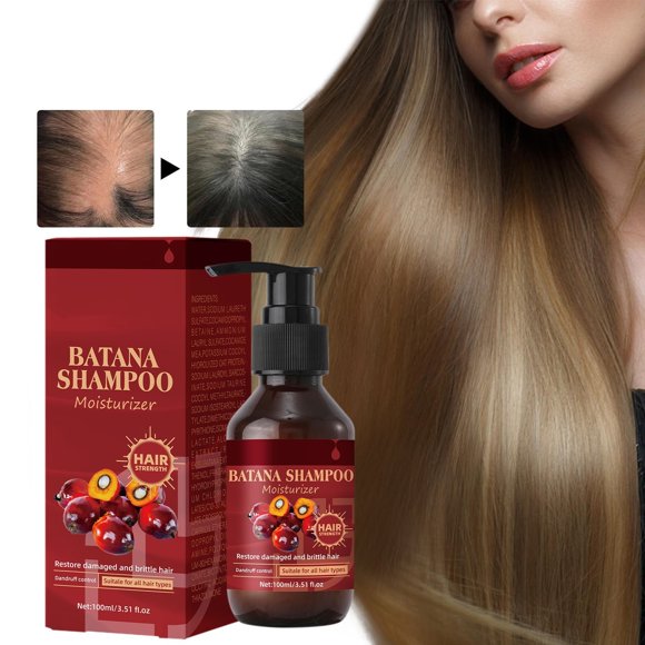 Aceite Capilar Batana para Un Cabello Más Sano y Grueso | Aceite para El Cuero Cabelludo y El Cabello para Hombres y Mujeres (100 Ml) - Promueve El Crecimiento, Mejora La Textura y La Hidratación | T