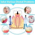 thumbnail image 2 of XIRQI 2026 New 120Pcs Interdental Brush 6 Sizes Braces Brush Toothpicks with Soft Bristles 360° Bendable Floss Heads Dental Brushes Between Teeth Gum Braces Hygienicing Oral Tooth Hygienicing Tool, 2 of 5
