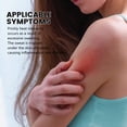 thumbnail image 4 of Prickly Heat Cream Skin Care 30g, 4 of 5