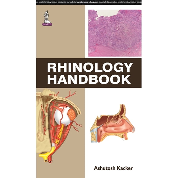 Rhinology Handbook - Kacker, Ashutosh