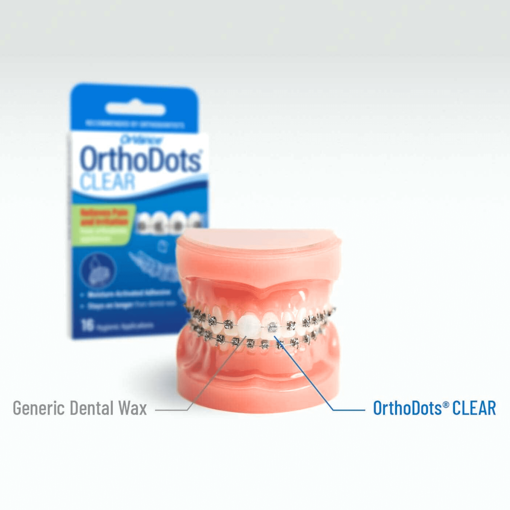 OrthoDots CLEAR -  Braces Wax Alternative for Pain Caused by Braces, Clear Aligner Trays, and Other Orthodontic Appliances - 2 Pack  (24 Count)