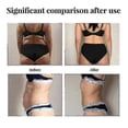 thumbnail image 3 of Sl Chang Abdominal Lifti, 3 of 5