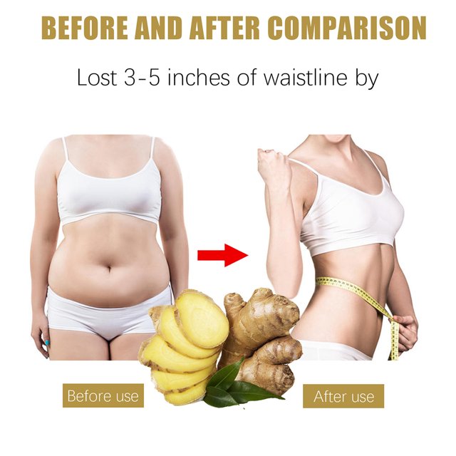Extracto de jengibre Aceite esencial Terapia de drenaje linfático Aceite delgado para todo el cuerpo Sywqhk Cuidado Belleza