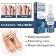 thumbnail image 5 of Antifungals Nail Treatments Spray In Medicals Quality, 30 Ml, Antifungals Nail Treatments, Antifungals Spray 30ml, 5 of 5