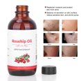 thumbnail image 4 of Rosehip Oil Massage Essential Oil Skin Beauty Essential Oil Aromatherapy Essential Oil 118ml Rosehip Oil Massage Essential Oil Moisturizing  Aromatherapy Body Massage Oil, 4 of 8