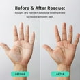 thumbnail image 6 of Dermasuri Day and Night Therapeutic Hand Cream for Dry, Cracked Hands - AM Lightweight Moisturizing Exfoliator & PM Overnight Renewal Lotion Softening Hydrating Treatment Unscented - Pack of 2, 6 of 7