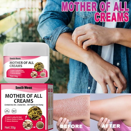 Herbal Ringworm Treatment Cream Fights Ringworm On Foot & Hand Powerful