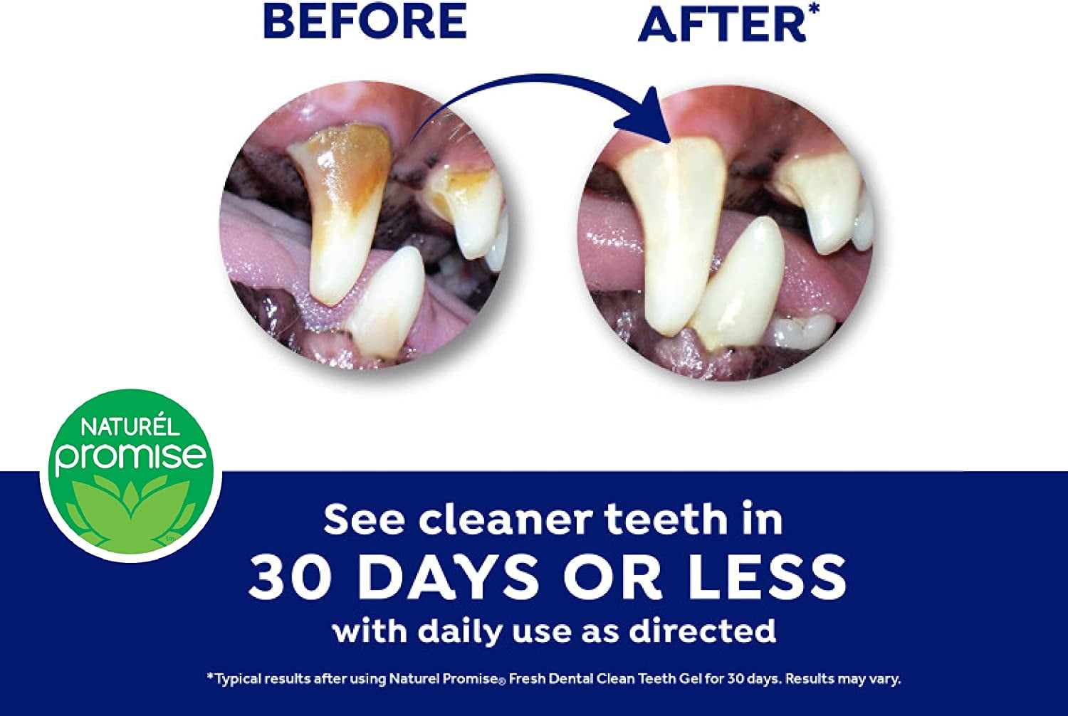 Fresh Dental FDGLKT4Z 4 oz Naturel Promise Fresh Dental Clean Teeth Gel