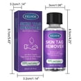 thumbnail image 3 of Líquido para eliminar verrugas, líquido para eliminar la piel del cuello, excrecencia de la piel Facial, líquido acuminado axilar, 30ML, 1,01 FLOZ, 3 of 4