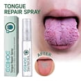 thumbnail image 2 of EELHOE Tongue Repair Spray Repairs white tongue coating and relieves tongue cracking and swelling oral care spray, 2 of 5