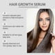 thumbnail image 2 of 1-3x Deoxyribose Sugar Gel Hair Growth, 60ml Deoxyribose Hair Growth Gel, Anti Hair Loss & Anti-Dandruff Scalp Treatment, 2 of 5