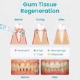 thumbnail image 5 of Ceoerty Gum Shield-therapy Gel, 5 of 5