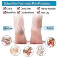 thumbnail image 5 of Silicone Heel Protector, Strong And Breathable Heel Protectors, Heel Cups For ,fast Heel Pain Relief, For Men And Women, 5 of 5