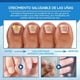 thumbnail image 3 of EELHOE Bolígrafo Luz Azul para Tratamiento de Hongos en Uñas - Elimina Onicomicosis y Paroniquia, 3 of 8