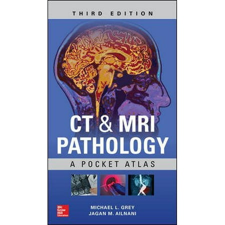 CT & MRI Pathology: A Pocket Atlas, Third Edition