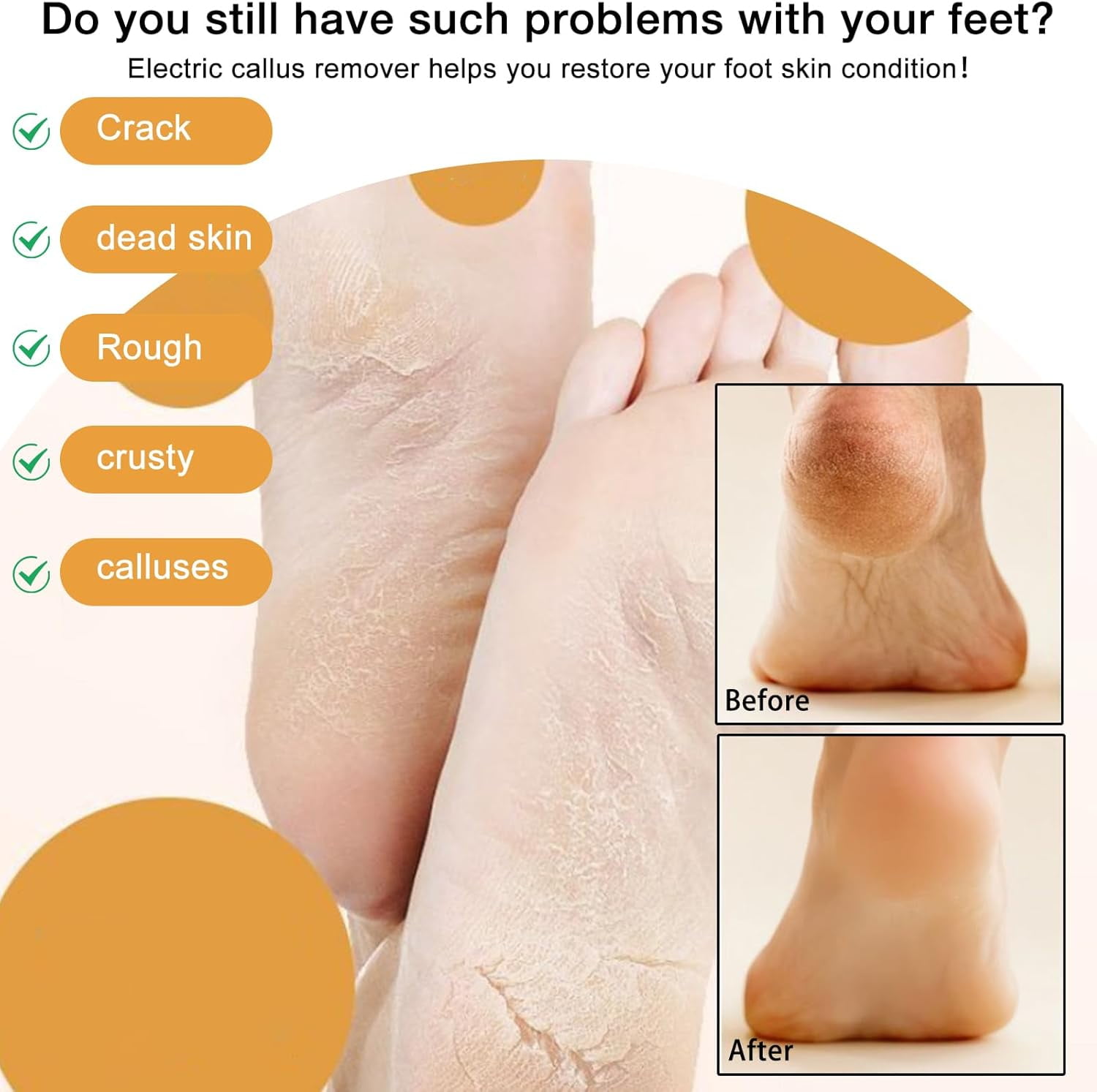 Upgrade Electric Foot File Callus Remover Digital Display 2 Speed With 3 Grinding Heads Foot Exfoliator Scrubber Grey