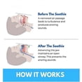 thumbnail image 5 of Honex Mouthpiece Universal Size, Fast & Effective Mouth, 5 of 5