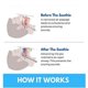 thumbnail image 5 of Honex Mouthpiece Universal Size, Fast & Effective Mouth, 5 of 5