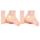 thumbnail image 1 of Refuerzos para el talón Qarigey Unisex Gel transpirable, 1 of 6