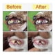 thumbnail image 3 of Dog Plaque And Tartar Remover, Ultrasonic Teeth Cleaner For And Cats, Ultrasonic Dental Kit, Dental, 3 of 5
