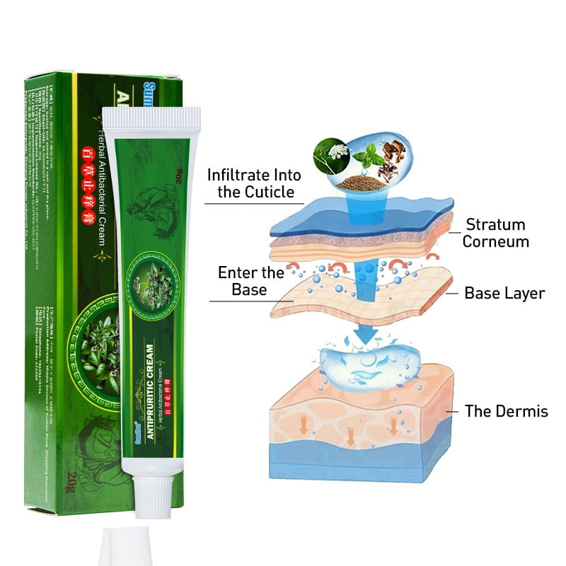 Buy Eczema Cream, Maximum Strength Treatment Ointment for Rash