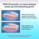 thumbnail image 3 of LZHF Dental Floss for Bridges and Implants 2 Packs - Floss Threaders for Bridges, Dental Implants, Braces with Extra-Thick Proxy Brush for Optimal Oral Hygiene -Teeth Bridge and Implant Clea, 3 of 5