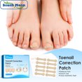 thumbnail image 3 of Guardurnaity Paquete de 60 parches para uñas encarnadas, adhesivo para uñas y cómodo, herramienta de alisado portátil autoadhesiva de tela no tejida Arte de uñas Guardurnaity CE013546-00, 3 of 6