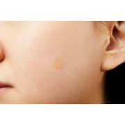 COSRX Acne Pimple Master Patch, 24 Ct