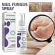 thumbnail image 2 of 1/2/3Pcs Medinail Fungus Spray,Toenail Fungus Treatment,Nail Fungus Treatment For Toenail, 2 of 5