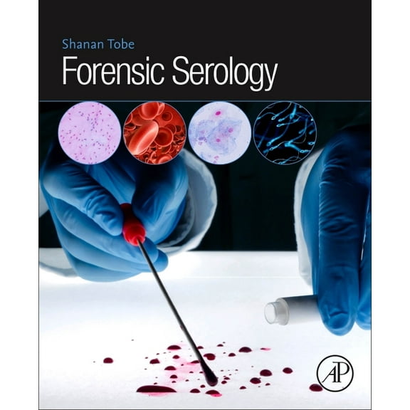 Forensic Serology, (Paperback)