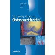 The Many Faces of Osteoarthritis, (Hardcover)
