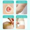 thumbnail image 3 of QARUN 30ML Colostomy Adhesive Wipe-off Spray Medical Adhesive Remover Care Product, 3 of 6
