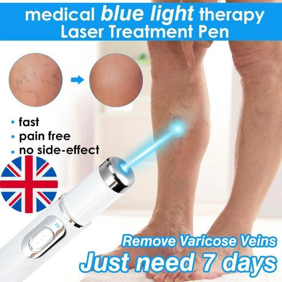 Blue Light Therapy Spider Veins