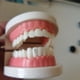 thumbnail image 3 of Venta caliente 4 piezas médicas de titanio puro dientes gemas cinco hojas slover dientes joyería superventas dientes gemas, 3 of 4