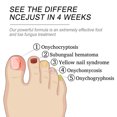 thumbnail image 3 of Toenail Treatment Gel, Easy To Apply Fingernail Repair Solution Moisturizing Strengthening  for Thick Nails, 3 of 8