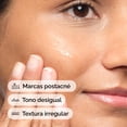 thumbnail image 3 of The Ordinary Aloe 2% + NAG 2% Solution, Suero para Tratamientos Post Acné con Aloe — Alivia la piel y mejora las marcas postacné, 30 ml, 3 of 5
