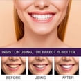 thumbnail image 3 of New- Purple Dentifrice Toothpaste Tooth Stains Anti-pigmentation Yellow Teeth, 3 of 4