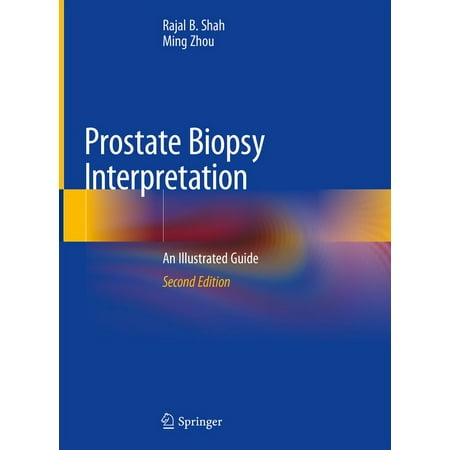 UPC: 9783030136000 | Prostate Biopsy Interpretation: An Illustrated Guide (Hardcover)