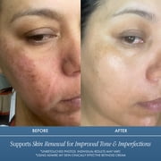 Admire My Skin Retinol + Vitamin C Hydrating Face Cream Moisturizer – Daily Skincare Treatment