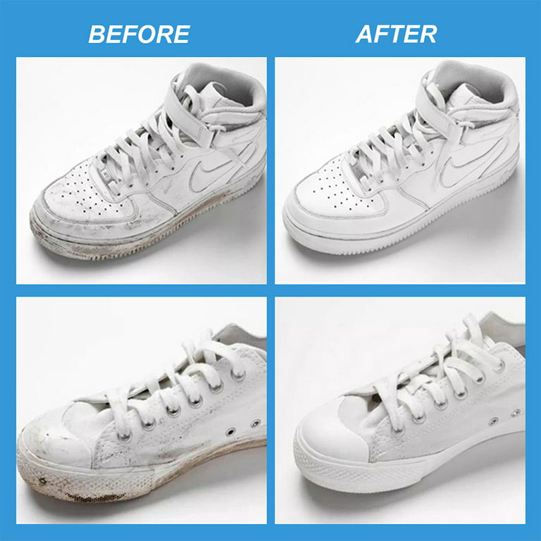 Shoes Whitening Cleansing Gel, Shoe Stain Remover, Yellow Stain Remover for  White Shoes, Shoe Cleaner for White Sneakers, Stain Remover Gel, for All