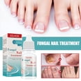 thumbnail image 4 of Nail Fungal Removal Essence 10ml Nail Fungal Removal Liquid Productos para el cuidado de los pies, 4 of 9