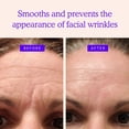 thumbnail image 2 of Parches antiarrugas BLUMBODY para rostro y frente, 160 parches, 2 of 7