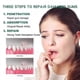 thumbnail image 3 of 1-3x Gum Regrowth Drops, Natural Gum Restore Liquid Mouthwash, Gum Therapy Drops Receding Gum Repair Treatment, 3 of 5