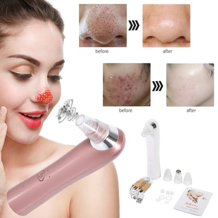 Electric Blackhead Cleaning Facial Acne Removal Machine Pore Vacuum Extraction Tool with 3 Replaceable Suction Heads to Exfoliate and Resurface the Skin USB Charging Gift for Women Mom