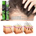thumbnail image 1 of Vaporisateur Liquide Anti-Chute de Cheveux 10ml, 1 of 2